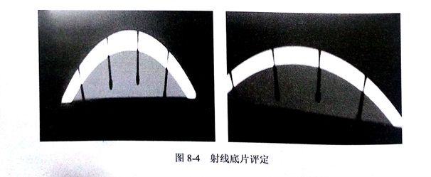 X射線檢測金剛石鋸片時出現的缺陷分析